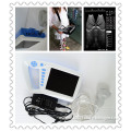 Handheld Digital Human Ultrasound Machine/Ultrasound Scanner